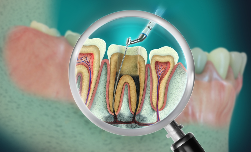 endodontics el paso